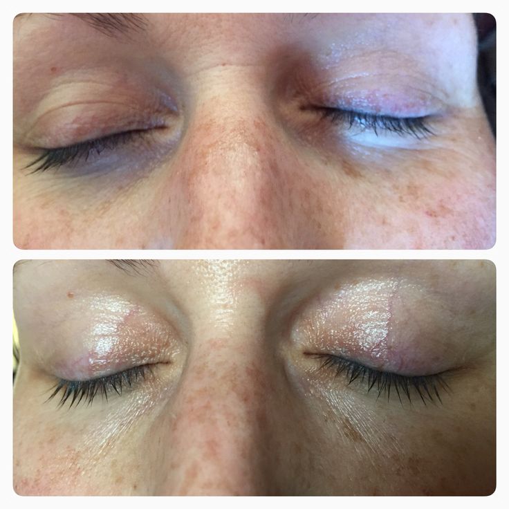 Aura Vellea™ Deep Relief Eye Massager